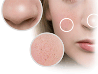 features_skin42.gif