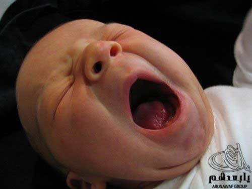 yawn6.jpg