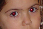 red-a.png